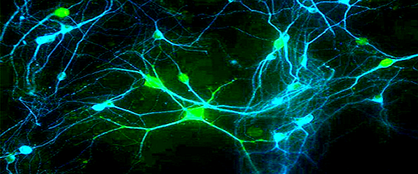 Neuroscience